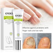 Fungal Removal Nail Treatment